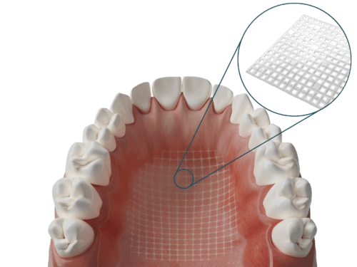 Dentapreg® MESH Transparent